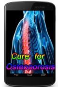 Cure for Osteoporosis mobile app for free download