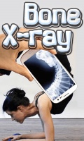 Bone X ray mobile app for free download