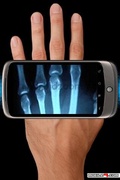 x ray mobile app for free download