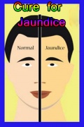 Cure for Jaundice mobile app for free download